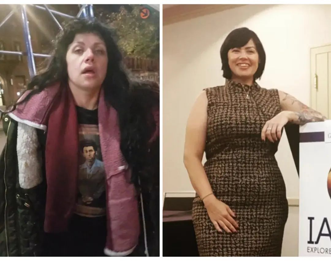 wQsGfHmdes7J-beforeandafterkra